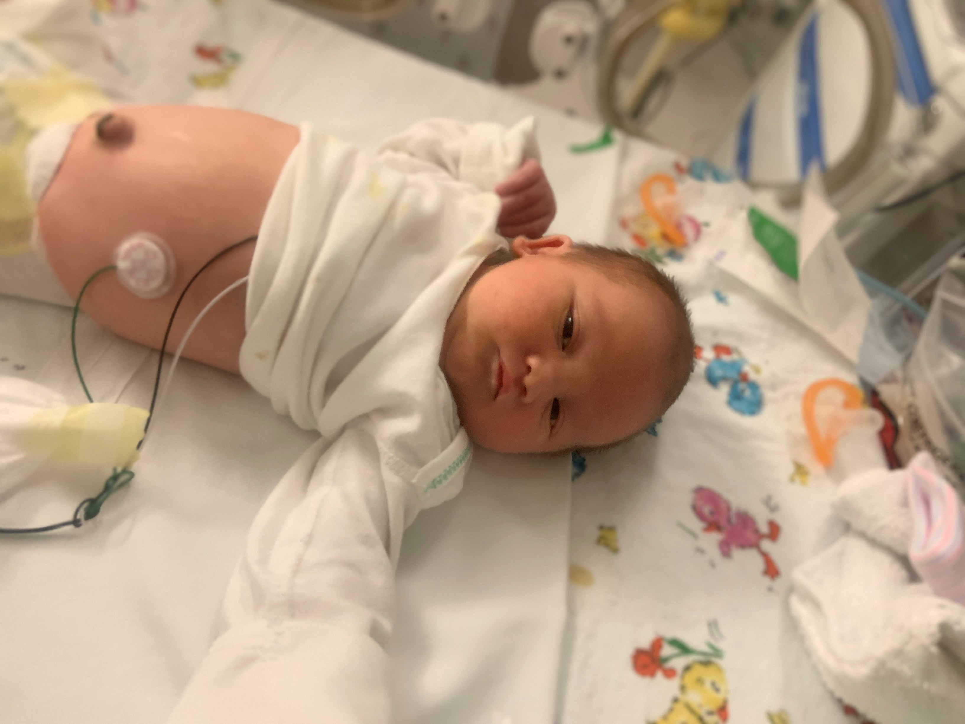 Newborn Miles in a NICU incubator
