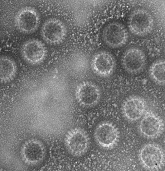 Dr. Jere's virus-like particles under a microscope