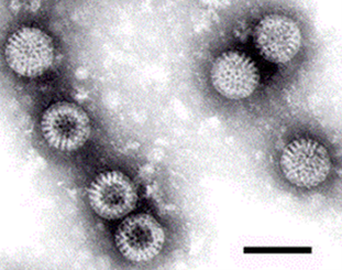 Rotavirus under a microscope
