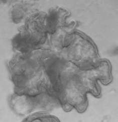 A grayscale microscopic image showing an irregularly shaped, semi-transparent cell with protruding edges and varying dark and light areas within its structure, representing mini guts grown in the lab to help treat norovirus.